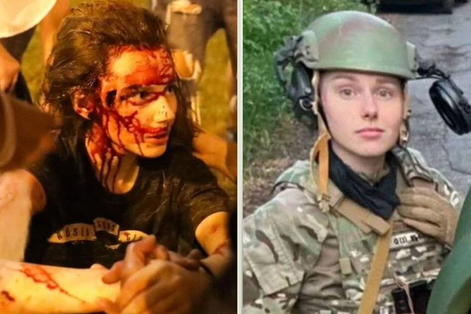 Maria Zaitseva prima ferita durante le proteste in Bielorussia e poi in uniforme militare in Ucraina, simbolo di resistenza e libertà.